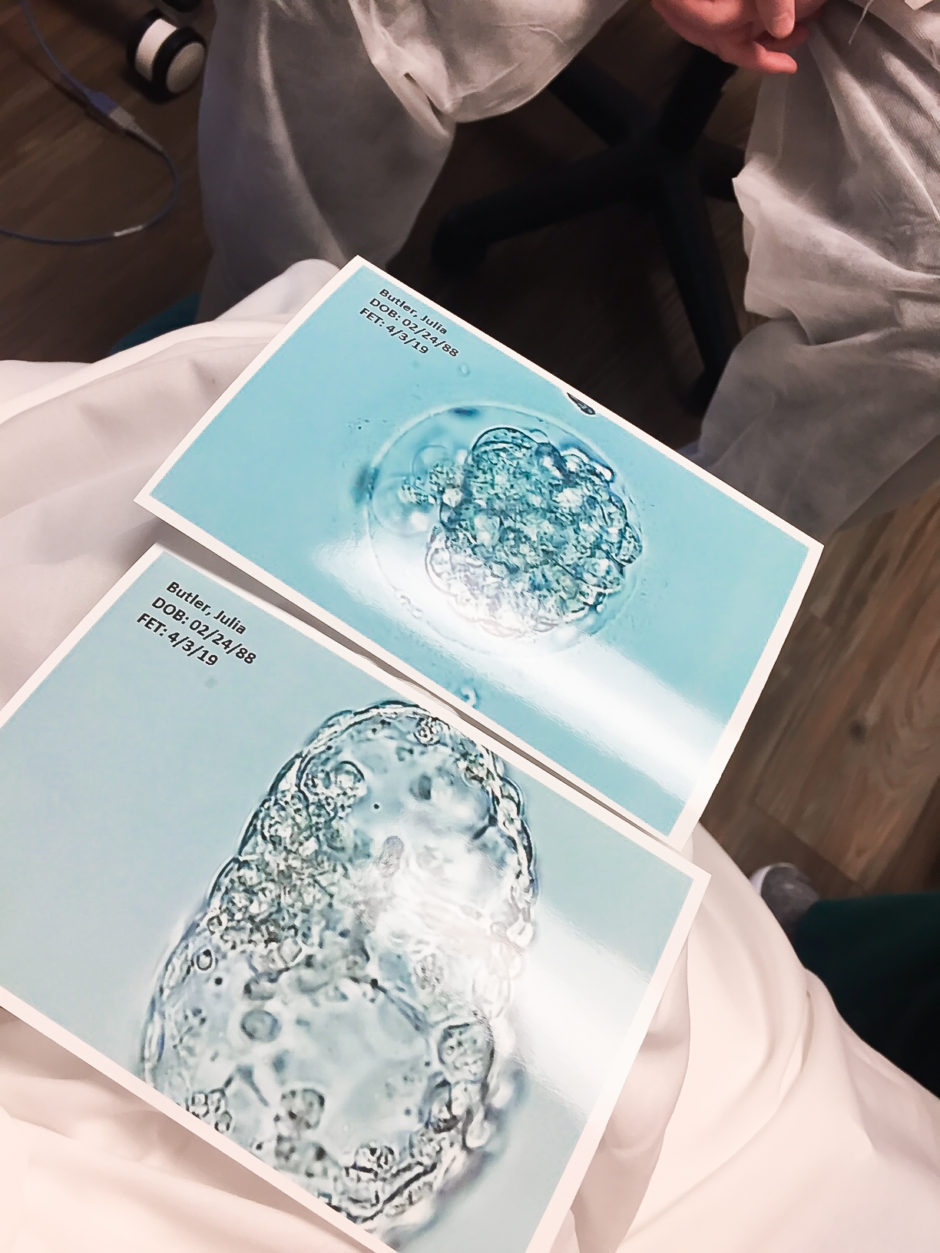 IVF IUI Success Story